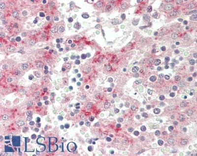 F13B / TGase Antibody (aa216-265, FITC)