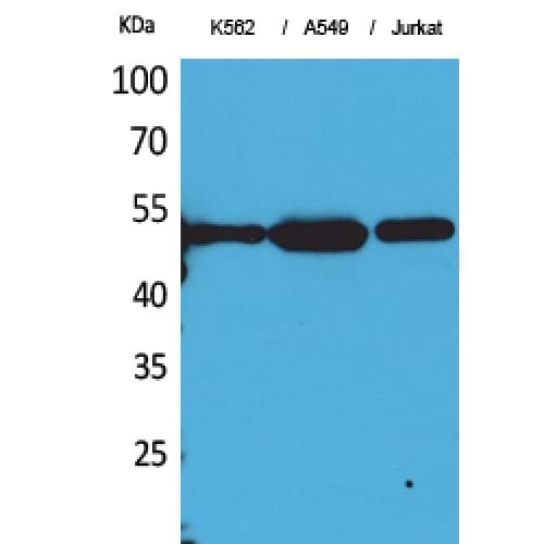 Polyclonal Rabbit anti-Human Alpha Tubulin Antibody (acetylation site of K352., WB)