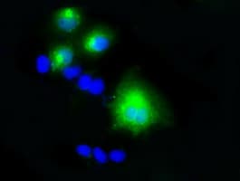 LIPG / Endothelial Lipase Antibody (clone OTI4C3)