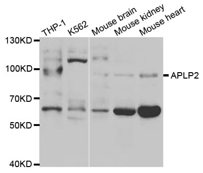 Polyclonal Rabbit anti-Human APLP2 Antibody (IHC, IF, WB)