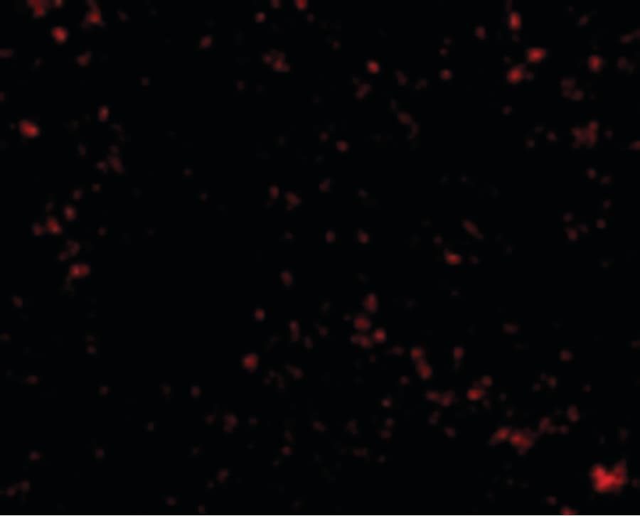 IHC-plus™ Polyclonal Rabbit anti-Human SKIL / SNO / SnoN Antibody (IHC, IF, WB)