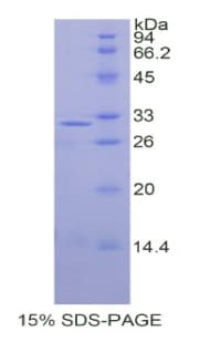 Human SEPT5 / Septin 5 Protein (Recombinant His)