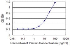 PathPlus™ ALDH1A1 / ALDH1 Antibody (clone 1G6)