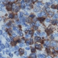 Polyclonal Rabbit anti-Human DOK2 Antibody (Internal, IHC, IF, WB)