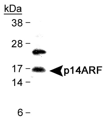p14ARF / CDKN2A Antibody (aa100-200, DY650)