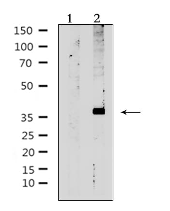Polyclonal Rabbit anti-Human AVPR2 / V2R Antibody (IF, WB)
