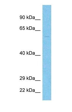 TMPRSS2 / Epitheliasin Antibody (C-Terminus)