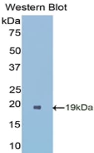 SOD1 / Cu-Zn SOD Antibody (aa2-154)