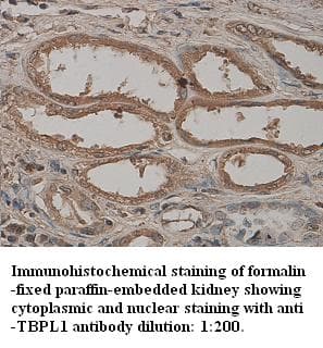 Polyclonal Rabbit anti-Human TBPL1 / TRF2 Antibody (Internal, IHC)