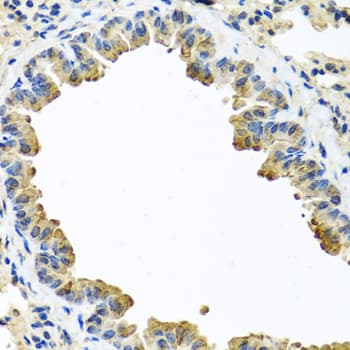 Alpha-1-Antichymotrypsin Antibody