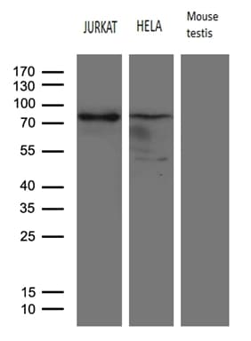 ELL / MEN Antibody (aa302-621, clone OTI5E12)