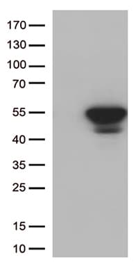 CDK15 / ALS2CR7 Antibody (aa293-378, clone OTI3B9)