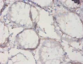 IL18BP Antibody