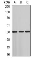 ST3GAL4 / ST3Gal IV Antibody