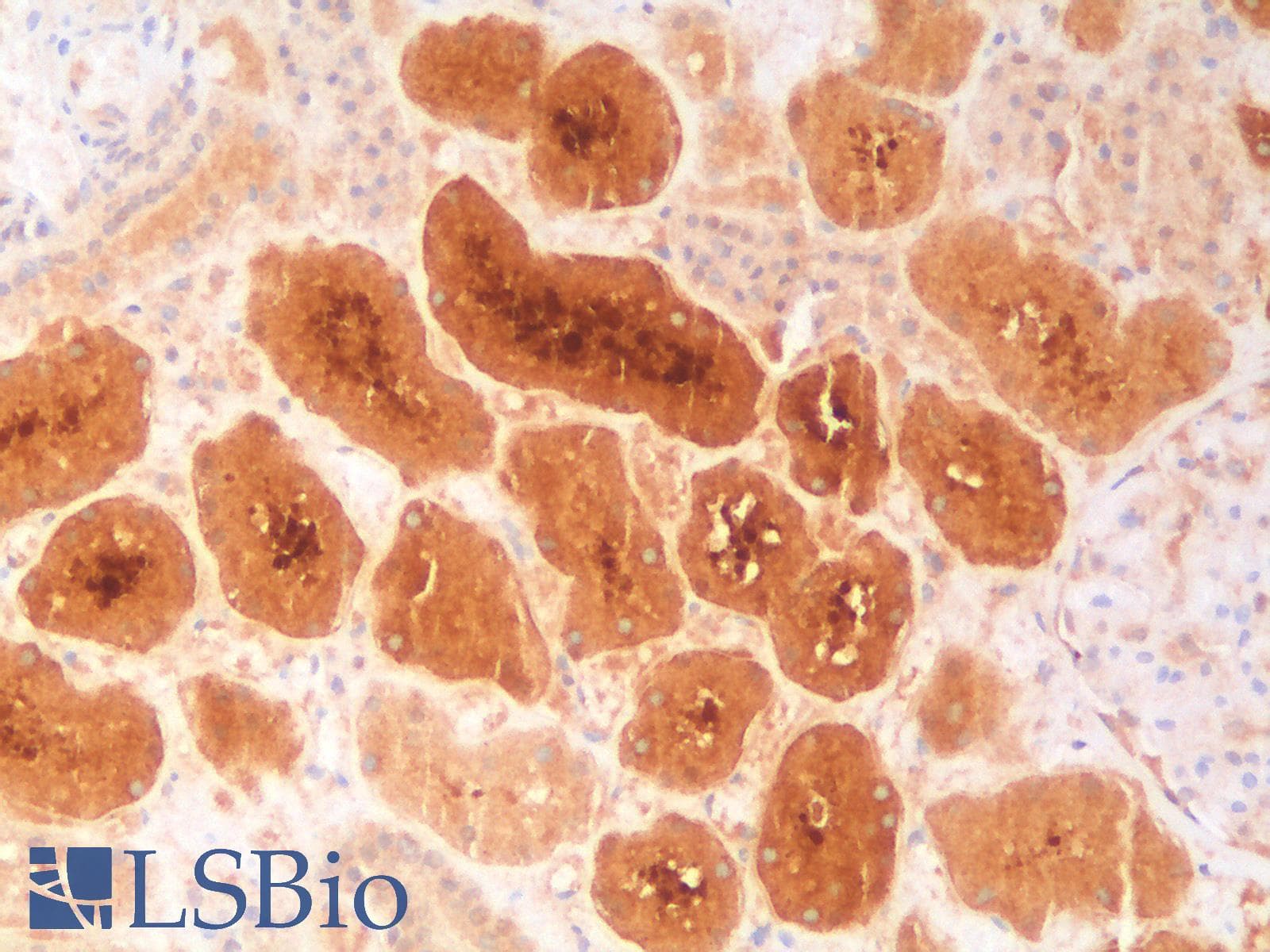 PathPlus™ Recombinant Monoclonal Rabbit anti-Human FTL / Ferritin Light Chain Antibody (clone FTL/2338R, aa 38-165, IHC, WB)