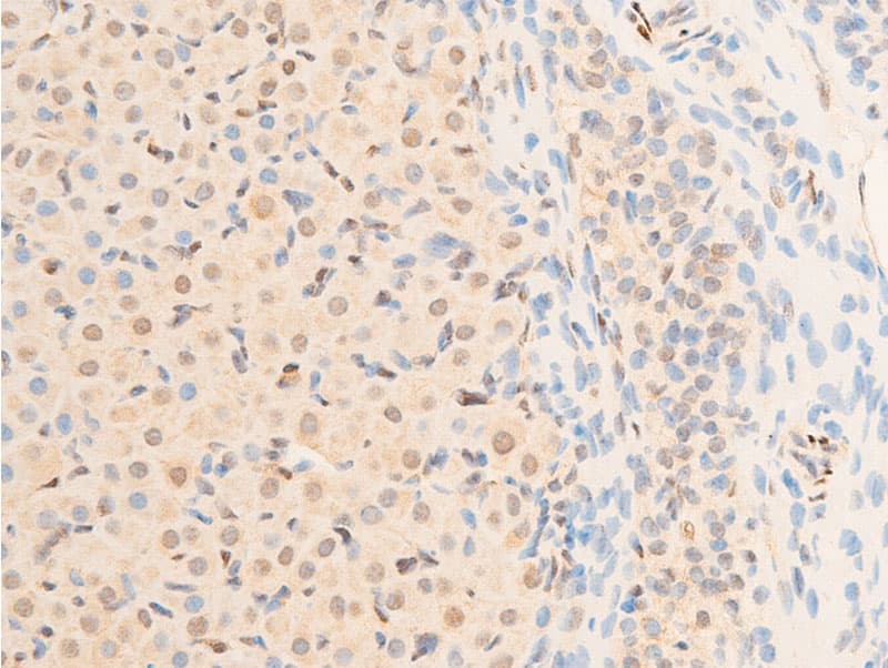 SGK1 / SGK Antibody (phospho-Ser422)