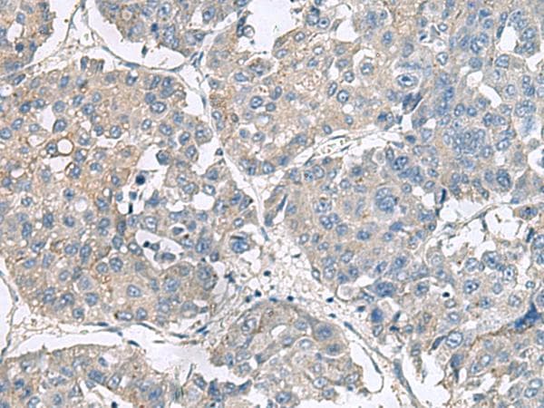 Polyclonal Rabbit anti-Human NPHP1 / Nephronophthisis Antibody (IHC)