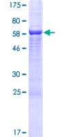 Human C4.4A / LYPD3 Protein (Recombinant GST)