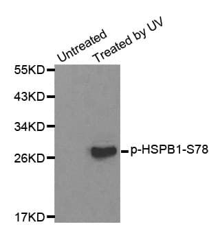 HSPB1 / HSP27 Antibody (phospho-Ser78)