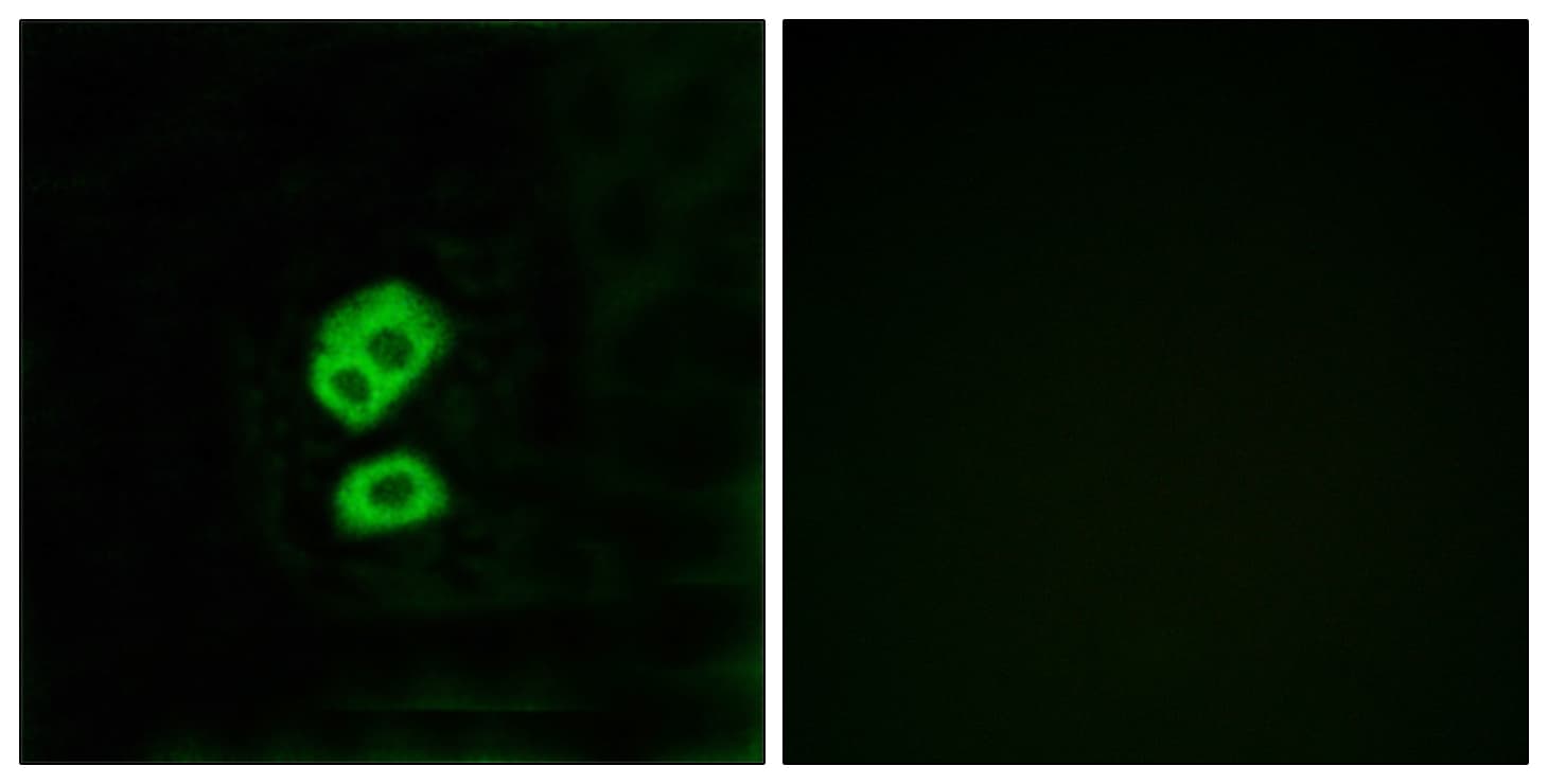 OR2T10 Antibody (aa141-190)