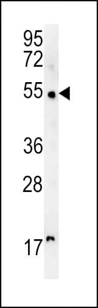 Polyclonal Rabbit anti-Human SCARA5 Antibody (aa385-413, IHC, WB)