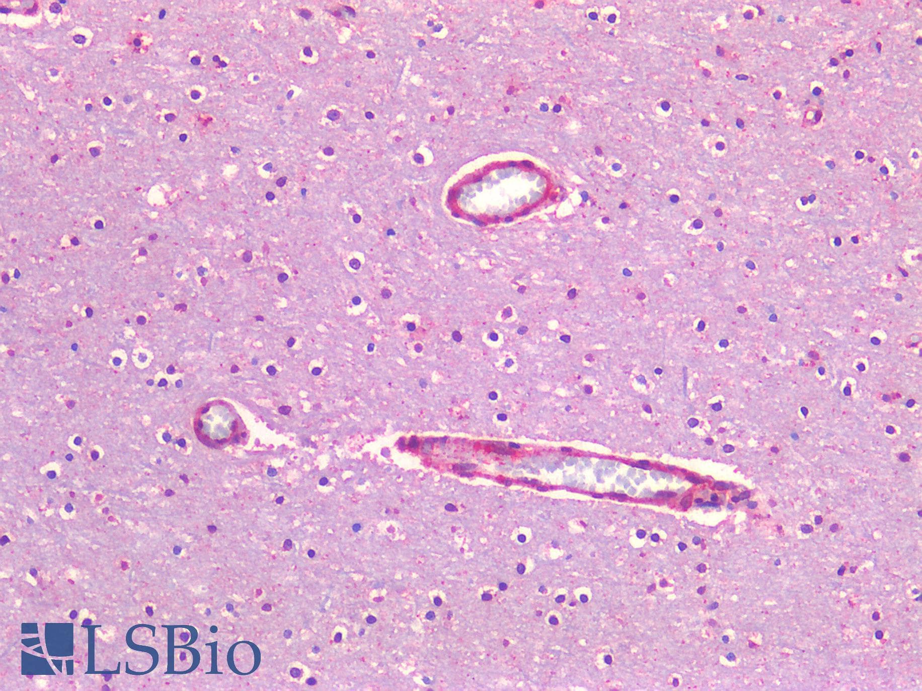 PathPlus™ Polyclonal Rabbit anti-Human CAV1 / Caveolin 1 Antibody (N-Terminus, IHC)
