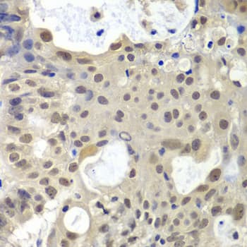Polyclonal Rabbit anti-Human U2AF1 Antibody (IHC, WB)