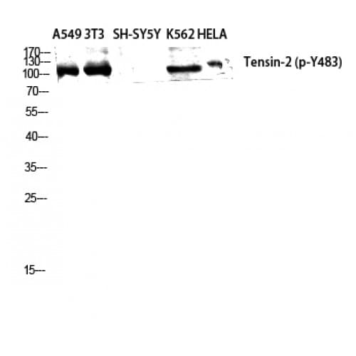 Polyclonal Rabbit anti-Human TNS2 / TENC1 Antibody (phospho-Tyr483, WB)