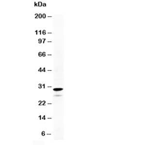 CALB2 / Calretinin Antibody (aa4-18)