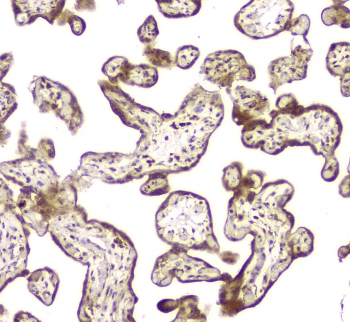 Polyclonal Rabbit anti-Human MCUR1 / CCDC90A Antibody (IHC, WB)