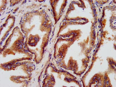 Polyclonal Rabbit anti-Human LZTS1 Antibody (IHC, IF)