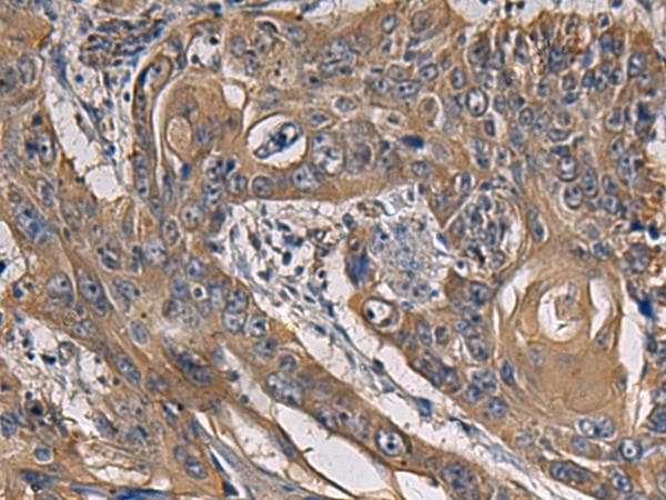 Polyclonal Rabbit anti-Human CCNI / Cyclin I Antibody (IHC)