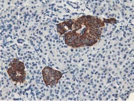 LPL / Lipoprotein Lipase Antibody (aa28-475, clone OTI4H3, Carrier-free)