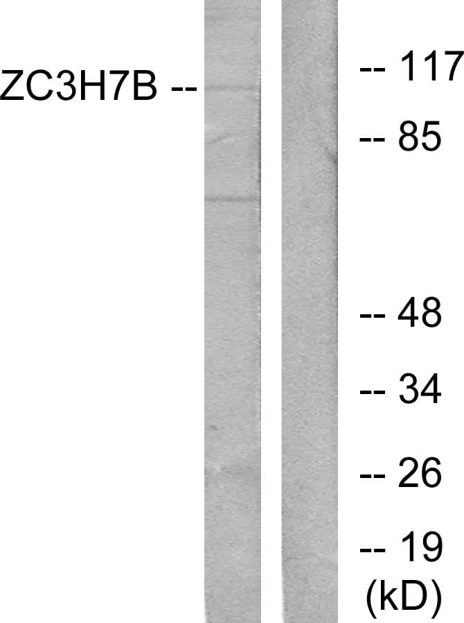 ZC3H7B Antibody (aa851-900)
