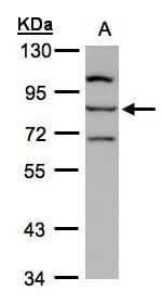 ALOXE3 Antibody (aa1-294)