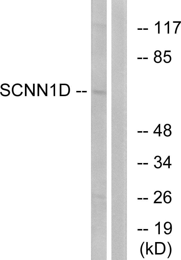 Polyclonal Rabbit anti-Human SCNN1D Antibody (IF, WB)