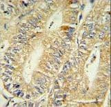 Polyclonal Rabbit anti-Human 15-PGDH / HPGD Antibody (aa184-212, IHC, WB)