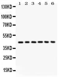 Polyclonal Rabbit anti-Human SELL / L-Selectin / CD62L Antibody (aa39-372, IHC, WB)