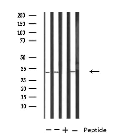 TOLLIP Antibody