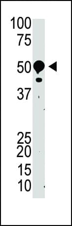 SUV39H2 Antibody (aa93-122)