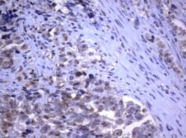 RASGRP3 / GRP3 Antibody (clone OTI2G7)