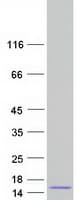 Human SPINT3 Protein (Recombinant Myc-DDK (Flag))