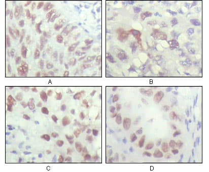 CHEK2 / CHK2 Antibody (clone 1C12B8)