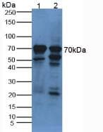 Alpha-Fetoprotein Antibody (aa31-171)