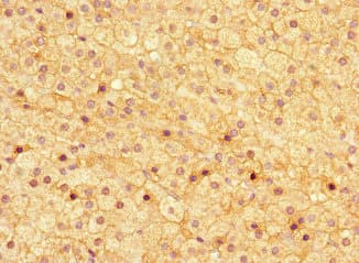 IHC-plus™ ASPN / Asporin Antibody