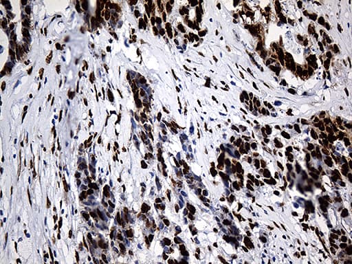 Monoclonal Mouse anti-Human PTBP3 / ROD1 Antibody (clone OTI5G7, aa300-552, IHC, WB)