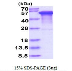 Human MAPT / Tau Protein (Recombinant His)