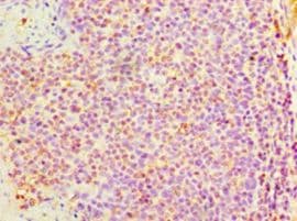 DNAH3 Antibody (aa1-150, Biotin)