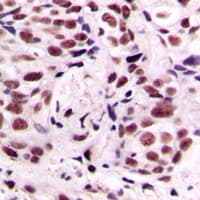 CREB1 / CREB Antibody (phospho-Ser133)