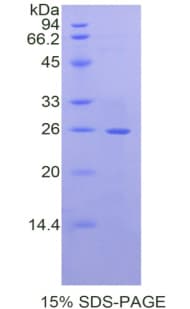 Mouse LAMB2 / Laminin Beta 2 Protein (Recombinant His)